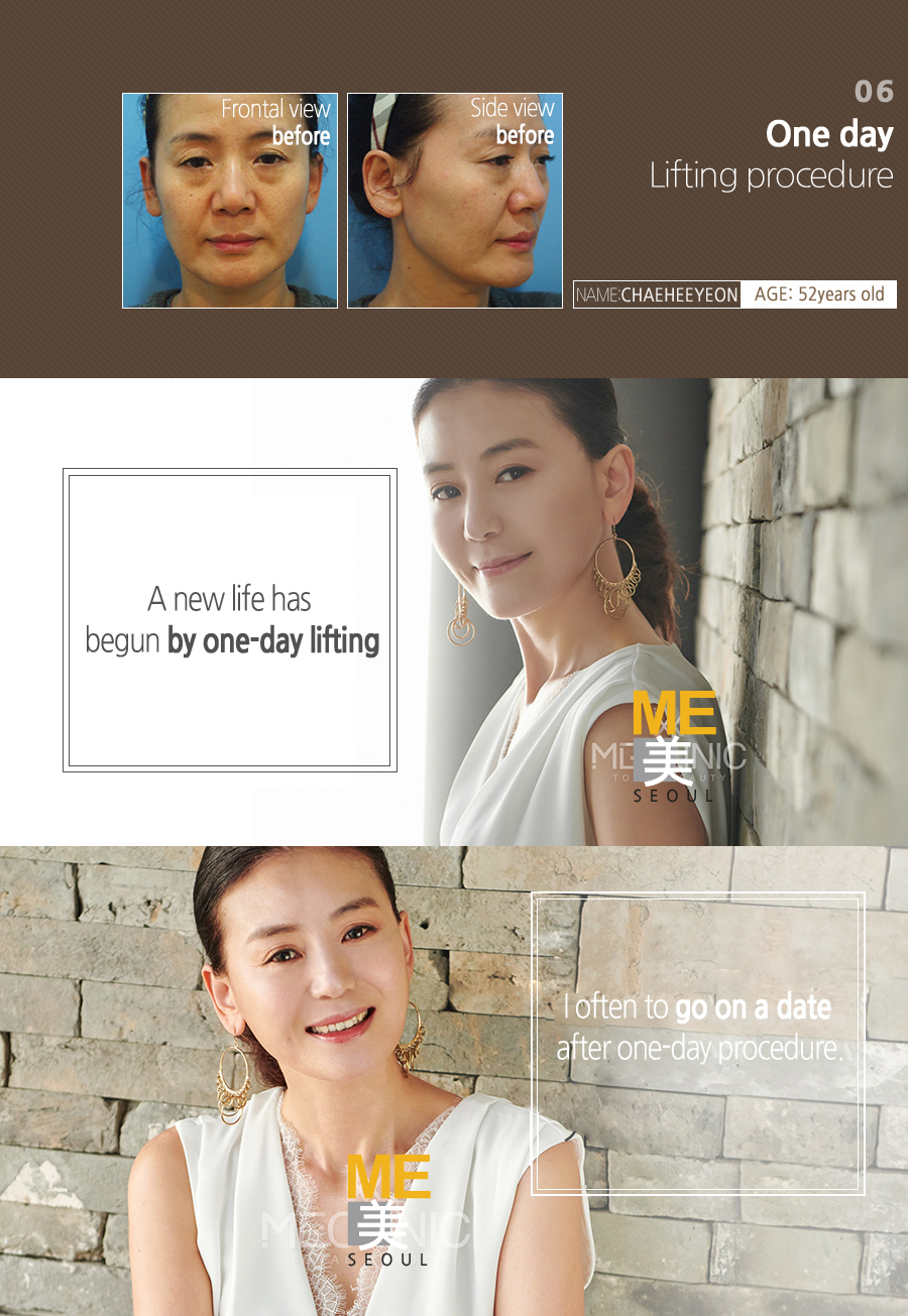 Reshape your body line in ME > Blog - ME CLINIC SEOUL